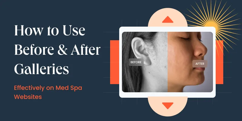 How to Use Before & After Galleries Effectively on Med Spa Websites